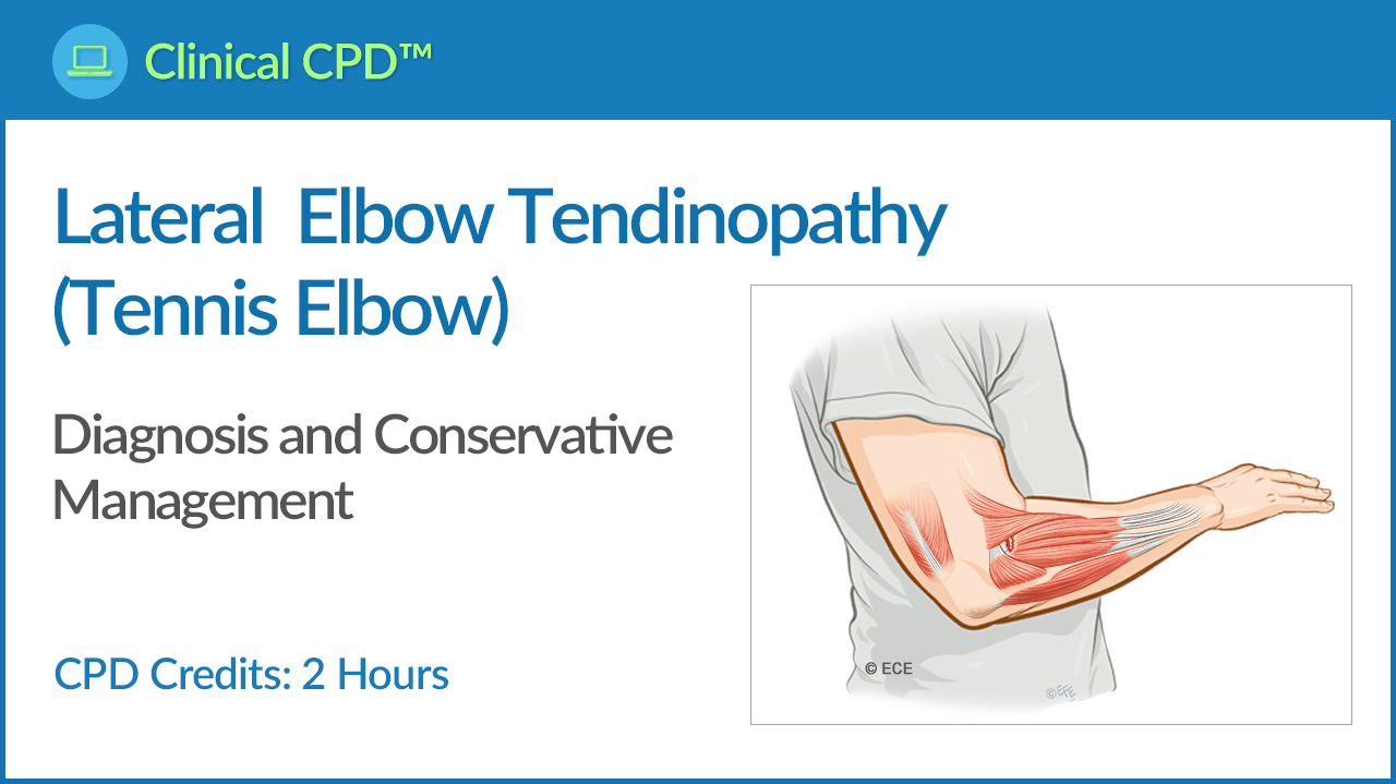 Disc Injury Causing Cauda Equina Syndrome